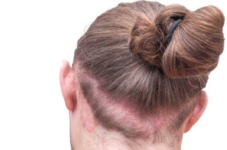 Soothing Scalp Solution Image